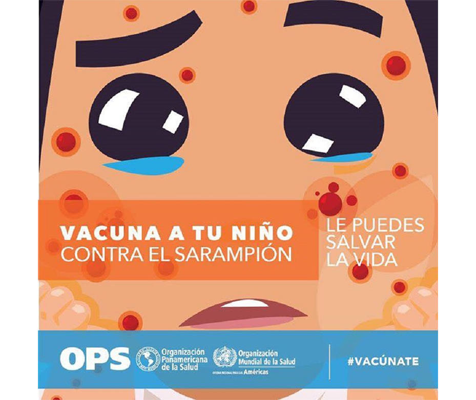 Alerta Sarampión niños deben contar con 2 dosis de vacuna para estar protegidos – 10-02-2020