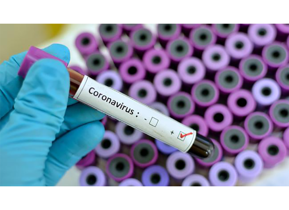 Nuevo coronavirus presenta bajo nivel de contagio y mortalidad