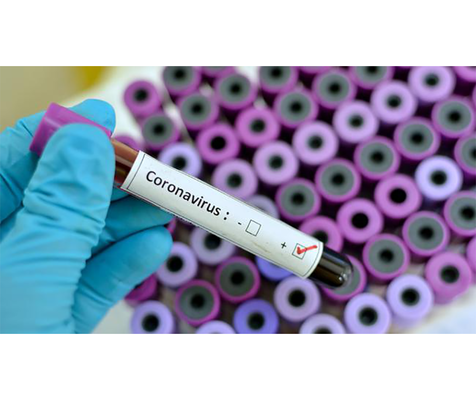 Nuevo coronavirus presenta bajo nivel de contagio y mortalidad – 04-02-2020