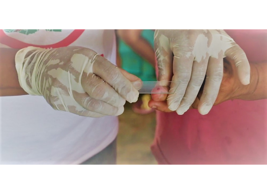 Fortalecerán procedimientos de vigilancia ante riesgo de reintroducción de Malaria