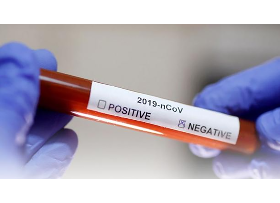 Al ingresar a los albergues son sometidos al test Covid-19