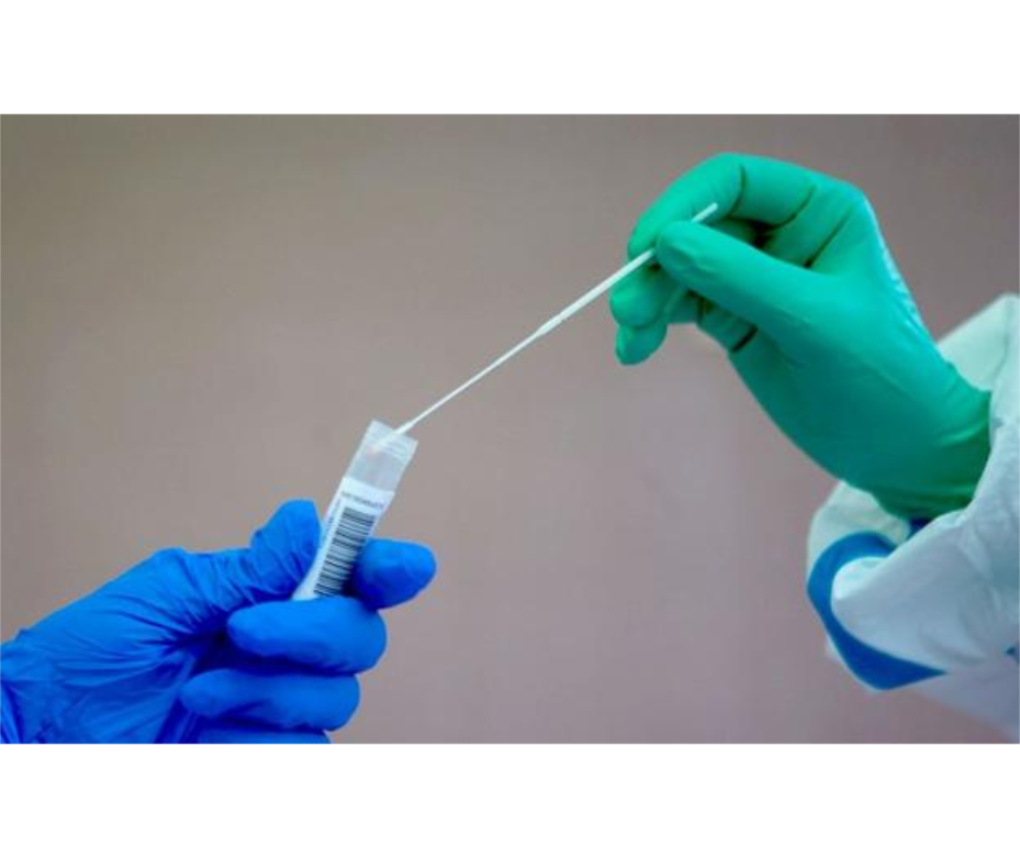 COVID-19 Test rápidos fortalecerán control de infectados y rastreo de contactos – 30-09-2020