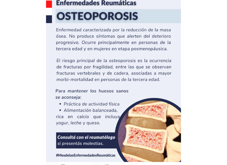 Osteoporosis: enfermedad caracterizada por la reducción de masa ósea