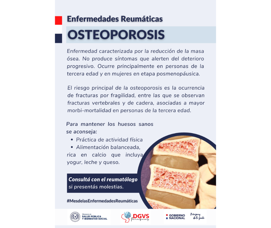 Osteoporosis enfermedad caracterizada por la reducción de masa ósea – 20-10-2021