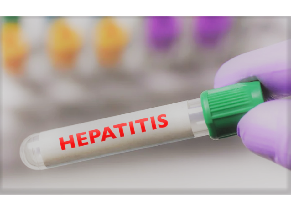 Hepatitis aguda en niños de causa desconocida continúa en investigación, señala OMS