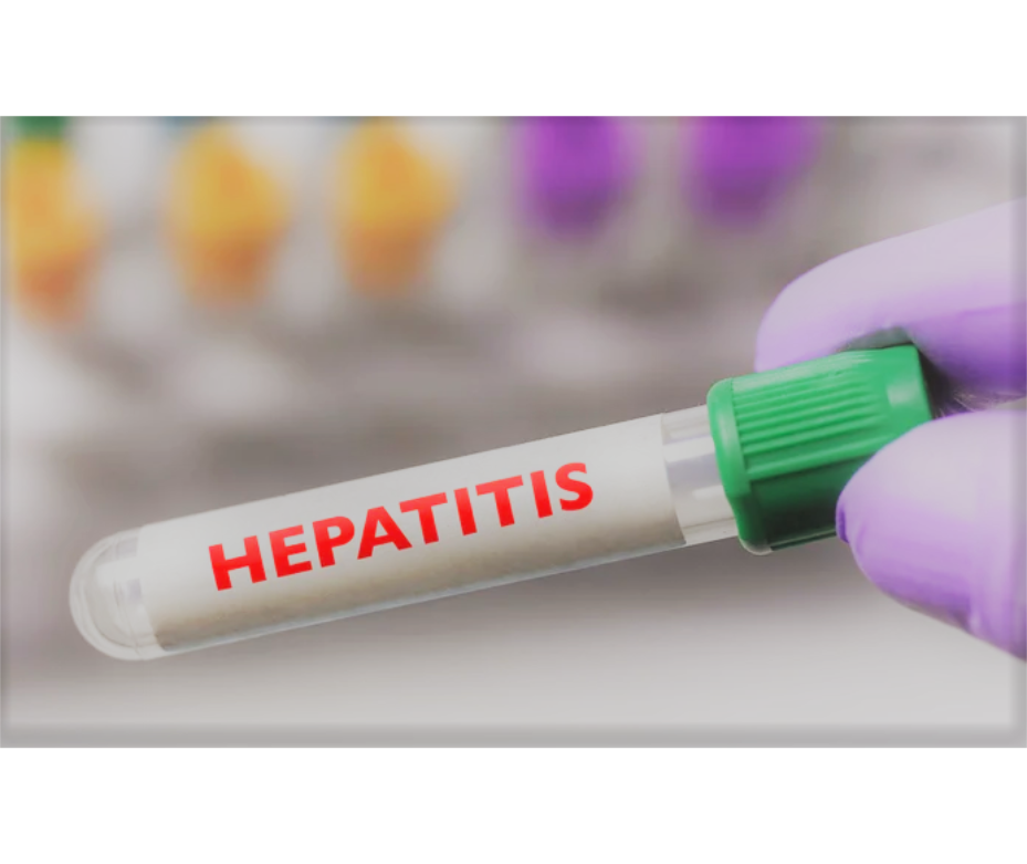 Hepatitis aguda en niños de causa desconocida continúa en investigación, señala OMS – 06-05-2022