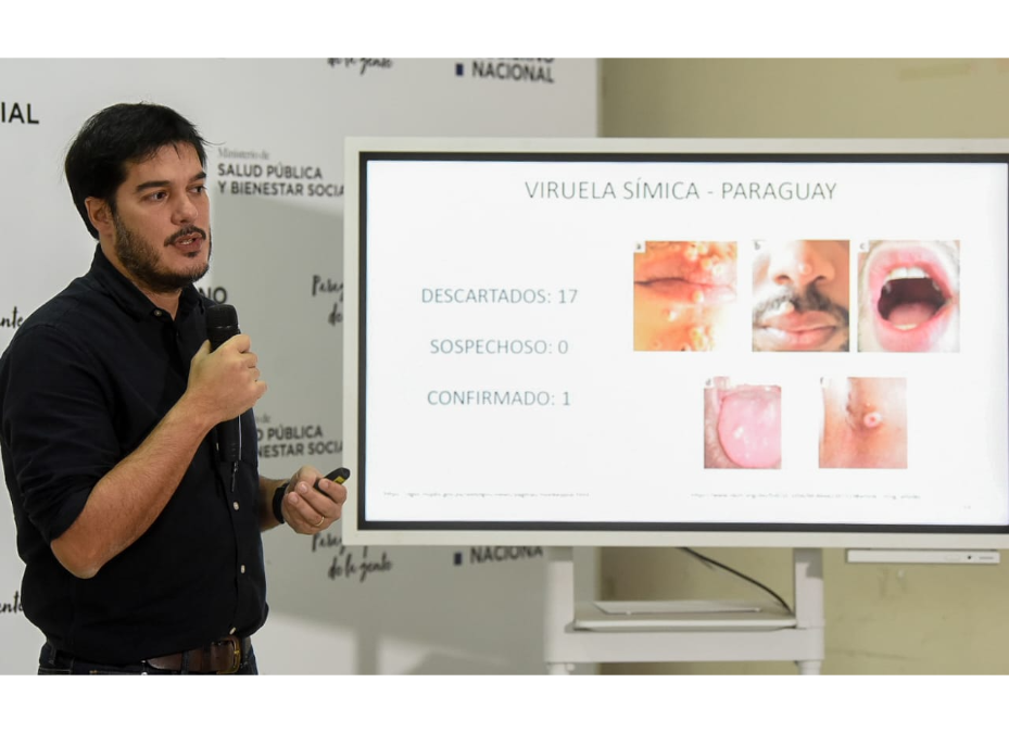Primer caso de viruela símica es de Central