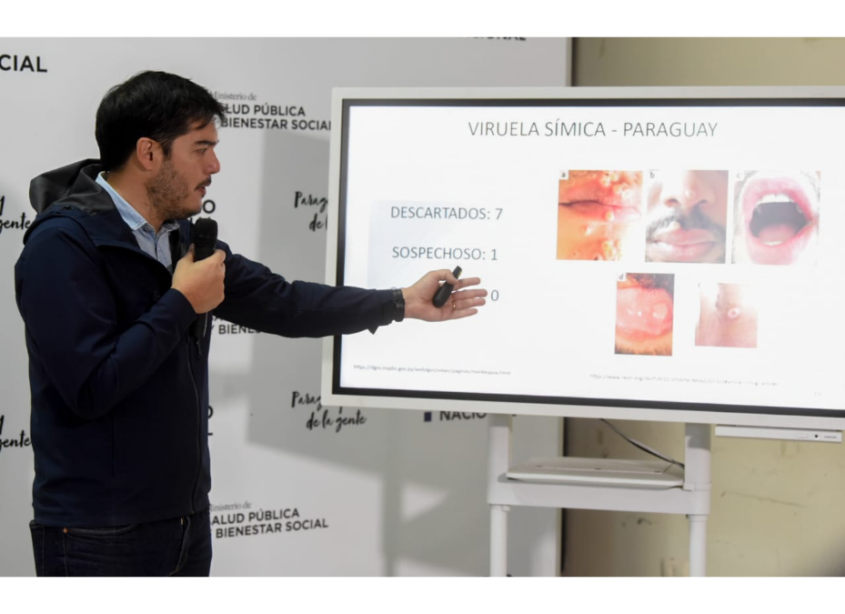 Se descarta caso sospechoso de viruela símica