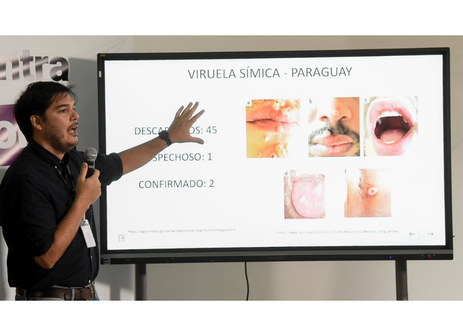 Viruela símica: Paraguay con 2 casos confirmados y uno en estudio