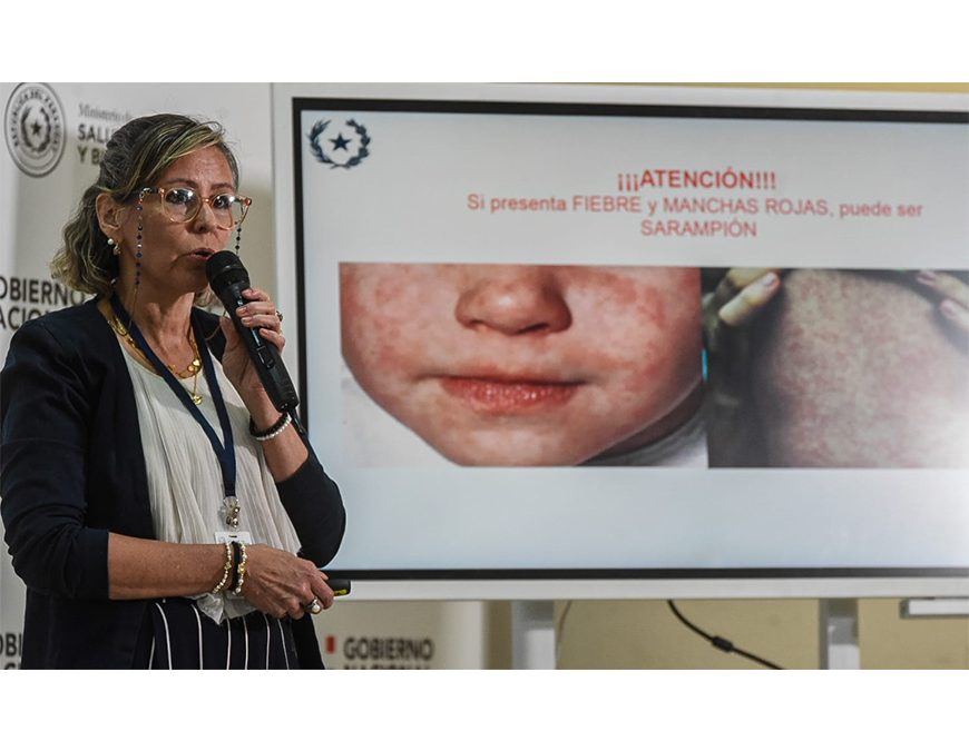 Luego de 25 años se confirma un caso de sarampión en el país