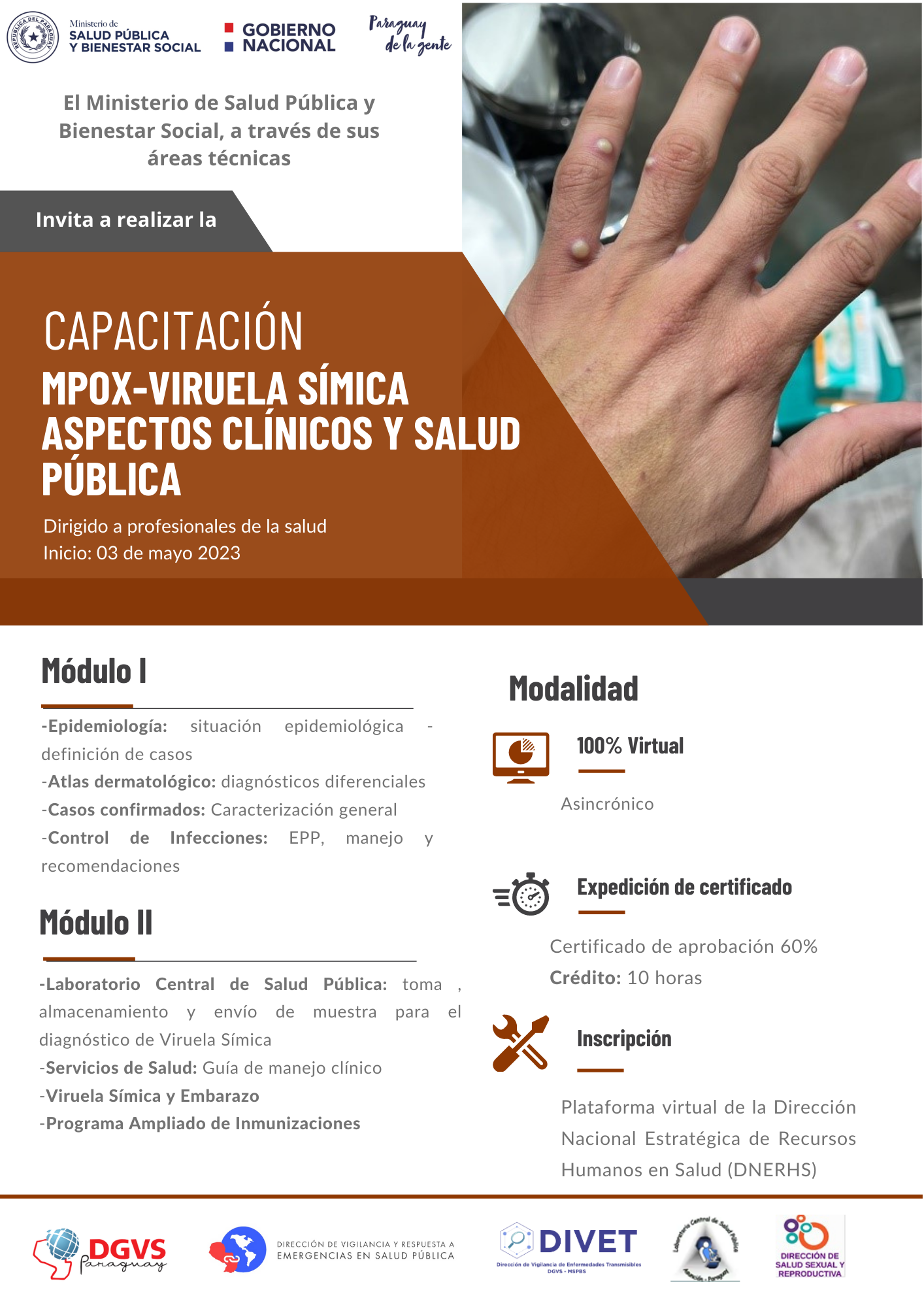 Inicia curso de capacitación virtual y gratuita en MPOX-Viruela Símica