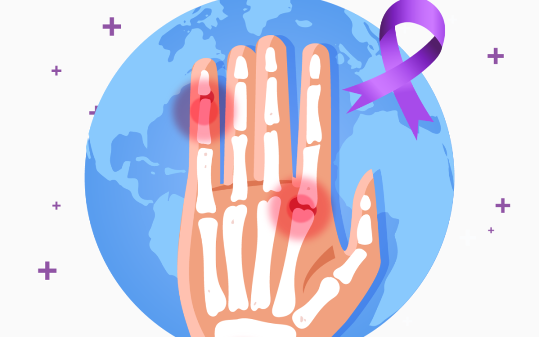 Artritis reumatoidea: enfermedad crónica que no tiene cura, pero puede ser tratada