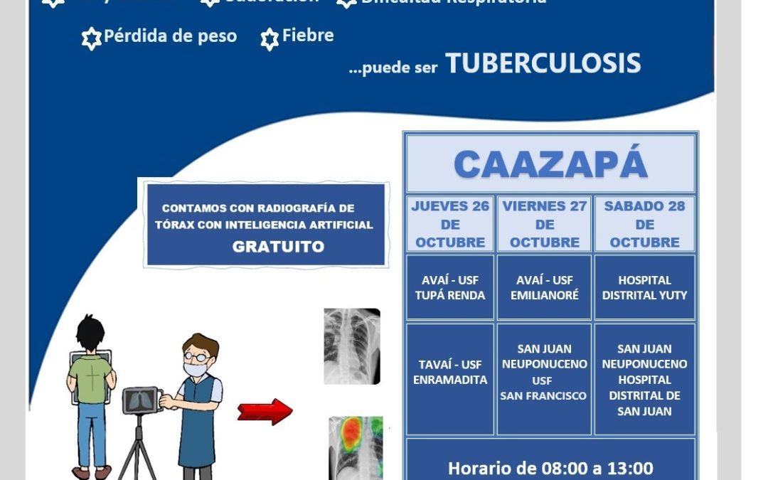Caazapá: Búsqueda de sintomáticos respiratorios y radiografía con IA aplicarán para diagnosticar tuberculosis