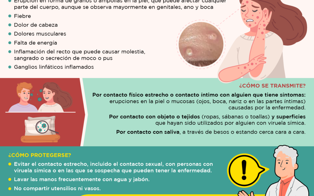 Medidas para prevenir la viruela símica