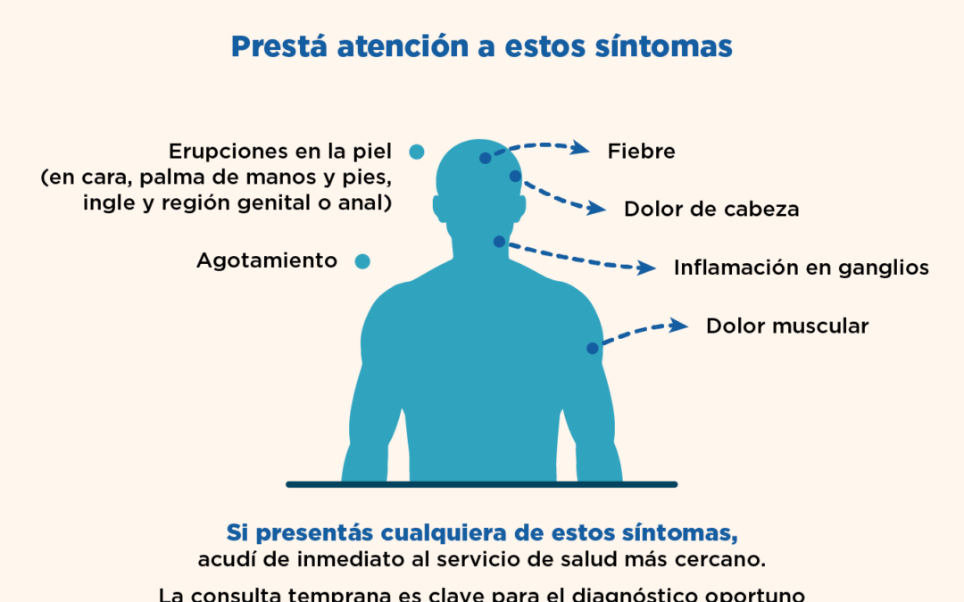 Mpox: Continúa la vigilancia activa en el país