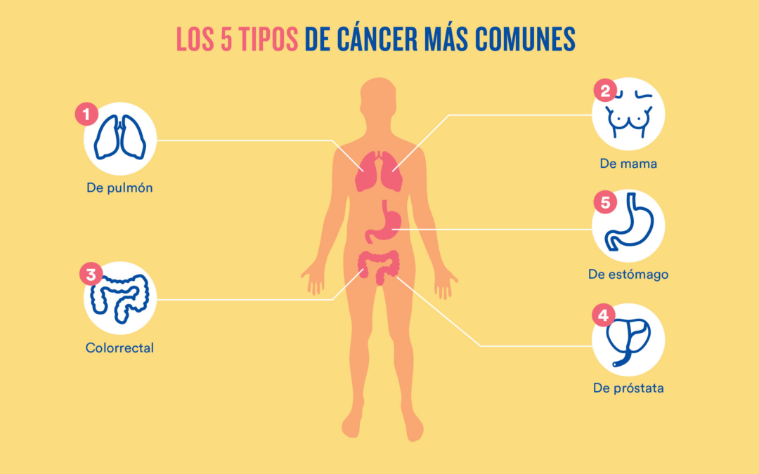 Cáncer, una de las principales causas de muerte a nivel global