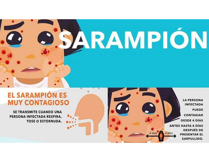 El sarampión se previene con vacunación