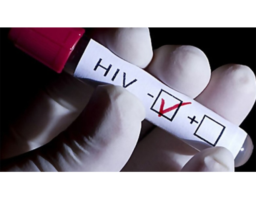 VIH: transmisión de la infección se da a través de fluidos corporales