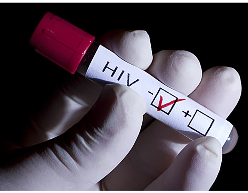 Vivir con VIH, la realidad sobre una infección crónica