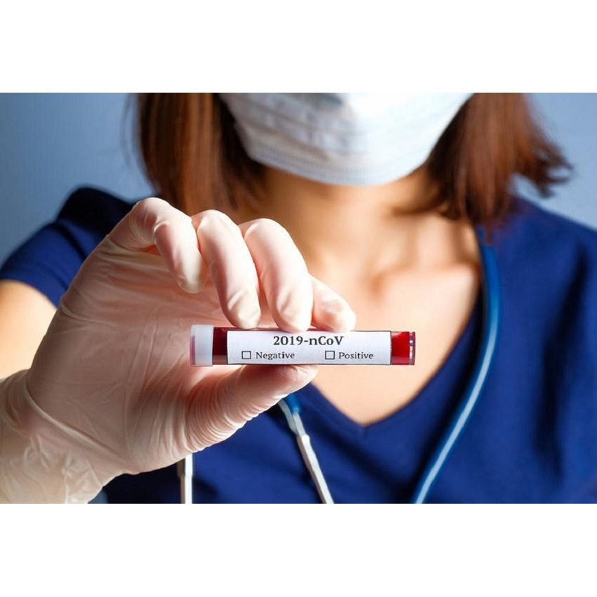 Dudas acerca de la enfermedad por coronavirus (COVID-19) – 26-02-2020