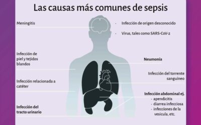 Sepsis: enfermedad peligrosa y frecuente que afecta a miles en el mundo
