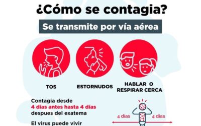 Continúa activa la vigilancia de sarampión
