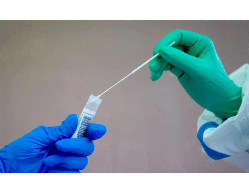 COVID-19: Test rápidos fortalecerán control de infectados y rastreo de contactos