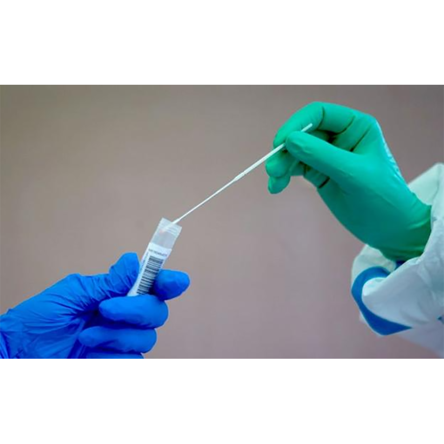 COVID-19 Test rápidos fortalecerán control de infectados y rastreo de contactos – 30-09-2020