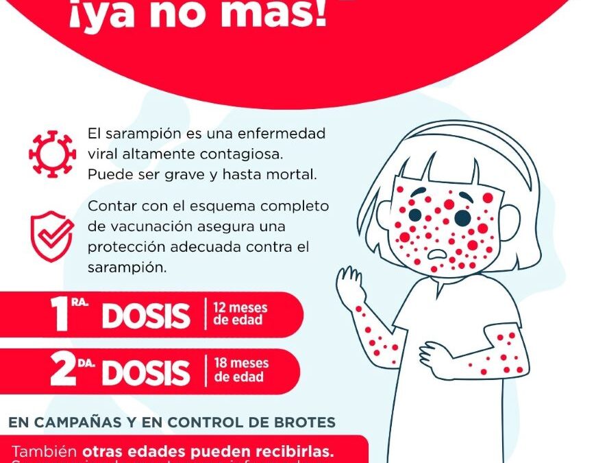 Sarampión: tras 12 semanas sin casos, se declara cerrado el brote en el país