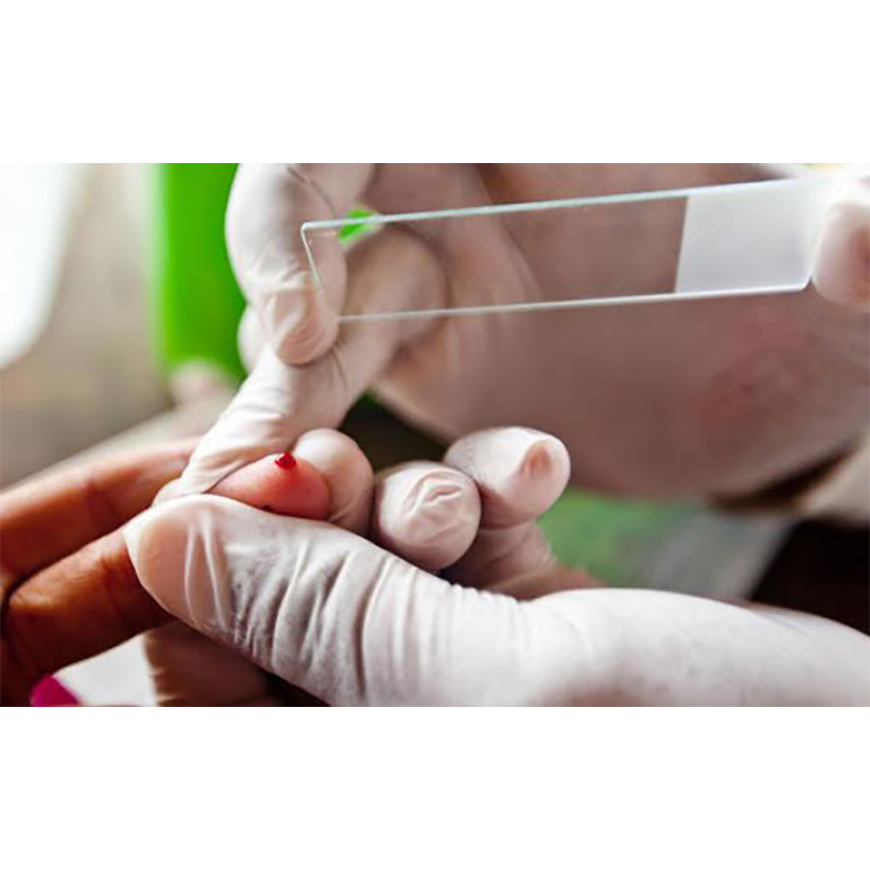 Articulan acciones para mantener al país libre de malaria – 15-02-2021