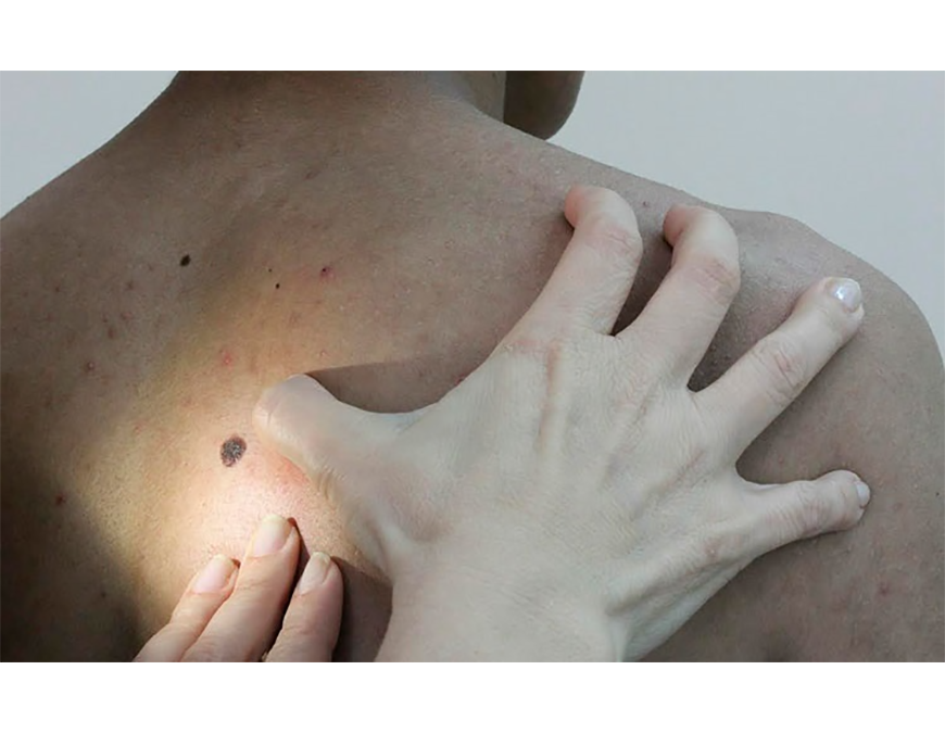 Detrás de una alteración cutánea puede esconderse alguna enfermedad