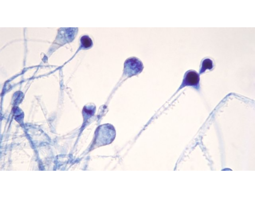 Lo que debes saber acerca del hongo negro