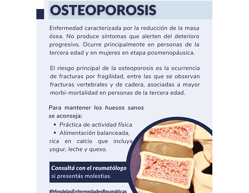 Osteoporosis: enfermedad caracterizada por la reducción de masa ósea