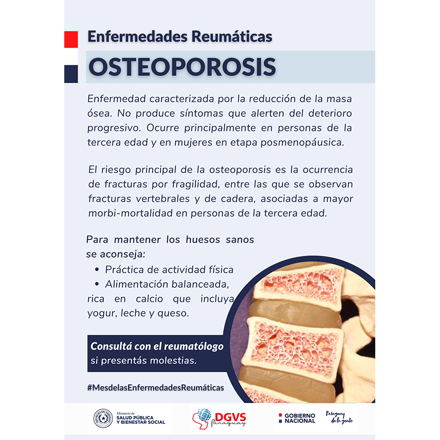 Osteoporosis enfermedad caracterizada por la reducción de masa ósea – 20-10-2021