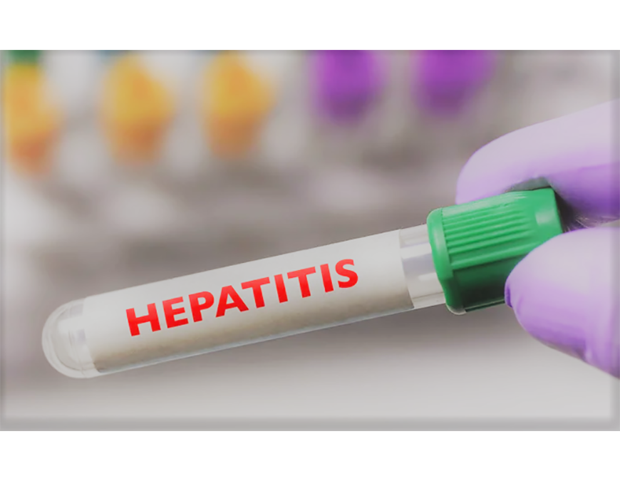 Hepatitis aguda en niños de causa desconocida continúa en investigación, señala OMS