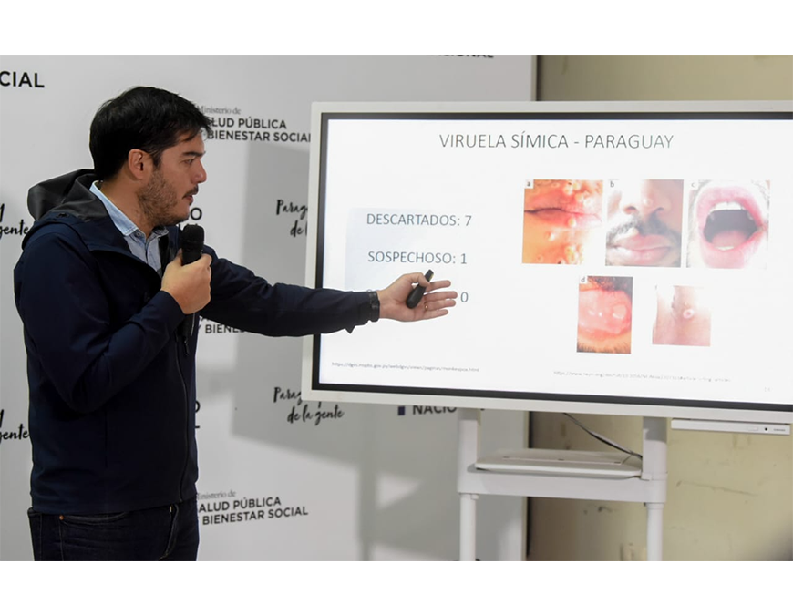 Se descarta caso sospechoso de viruela símica