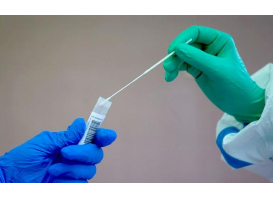 Llegaron a Paraguay 250 mil pruebas rápidas para detectar COVID-19