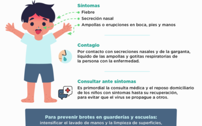 Cómo prevenir el contagio de la enfermedad de mano, pie y boca